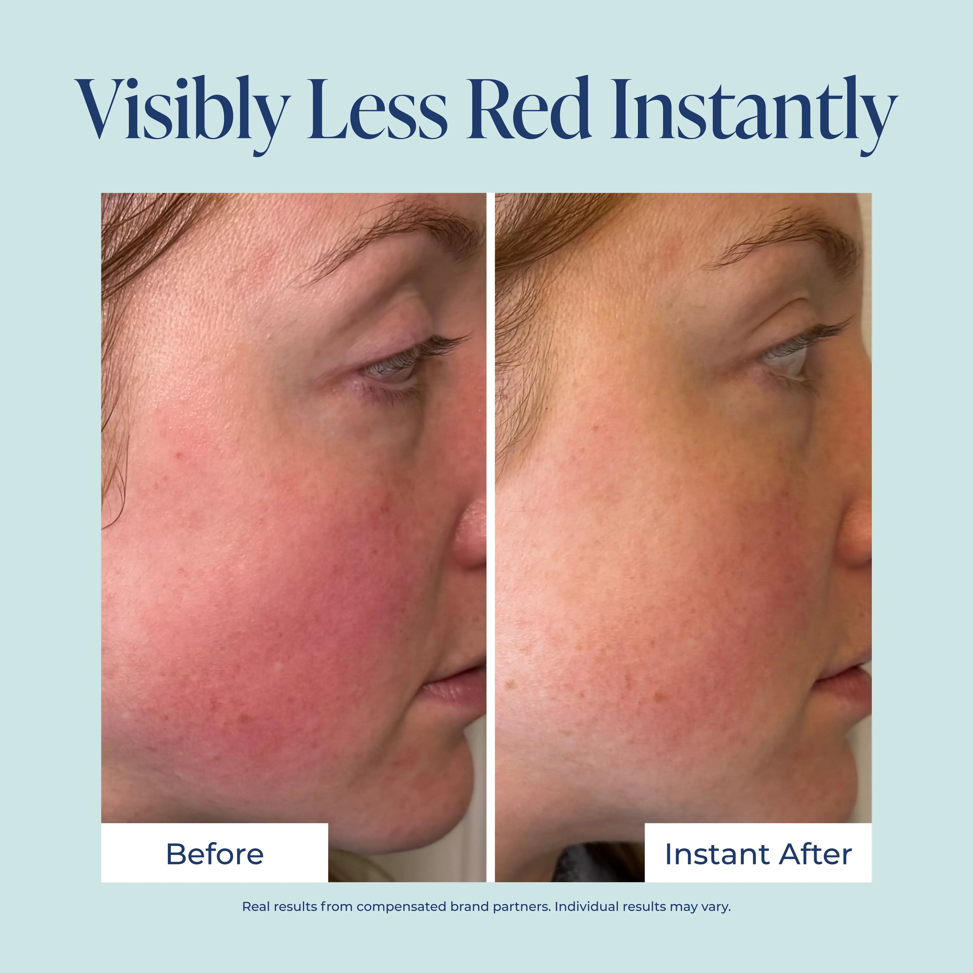 Redness Corrector for Face - Color Corrector, Redness Relief for Face - Smooths & Calms Sensitive Skin with Microcalm Blend, Ceramides, Vitamins, Antioxidants, Vegan Formula