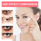 Retinol Under-Eye Cream Stick