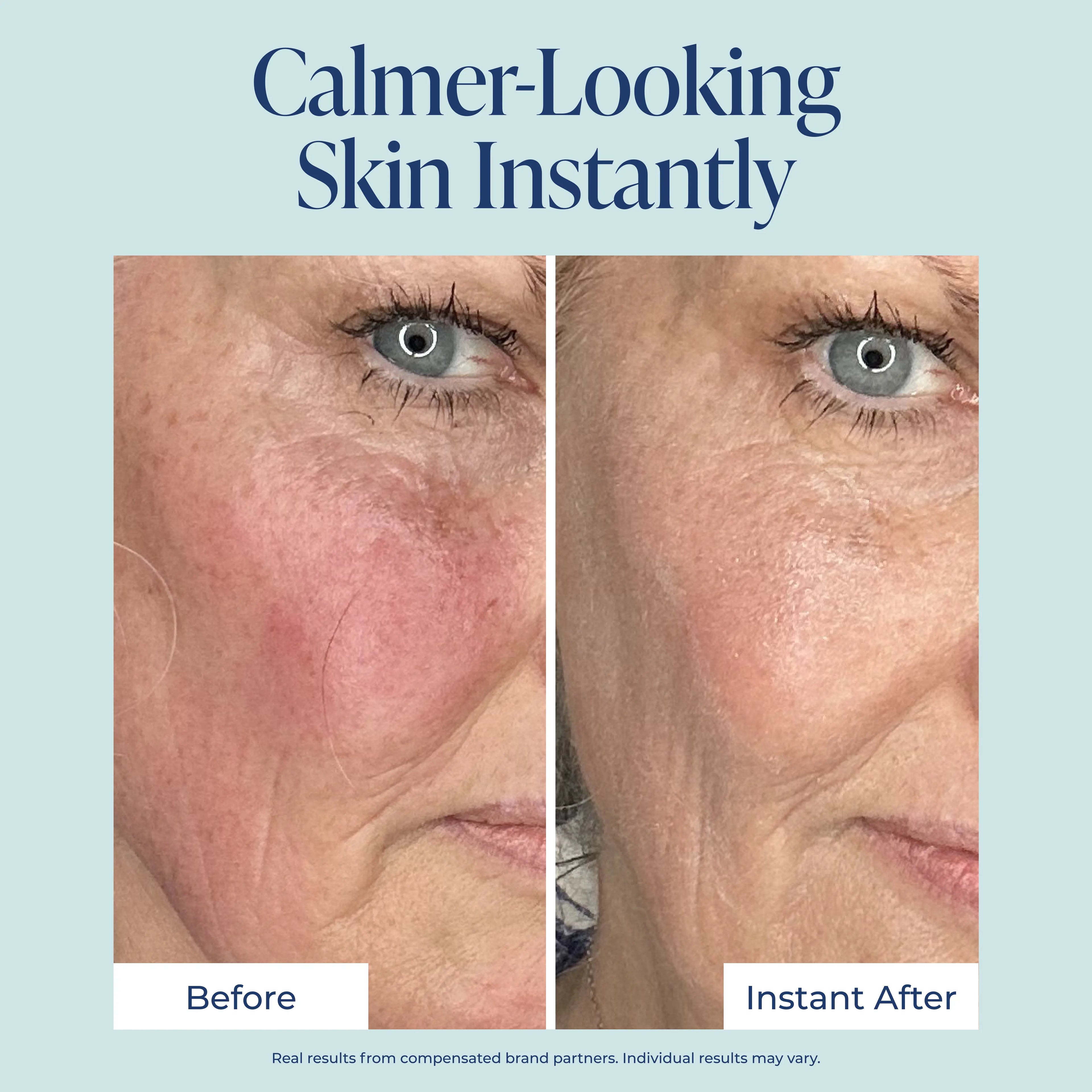 Redness Corrector for Face - Color Corrector, Redness Relief for Face - Smooths & Calms Sensitive Skin with Microcalm Blend, Ceramides, Vitamins, Antioxidants, Vegan Formula